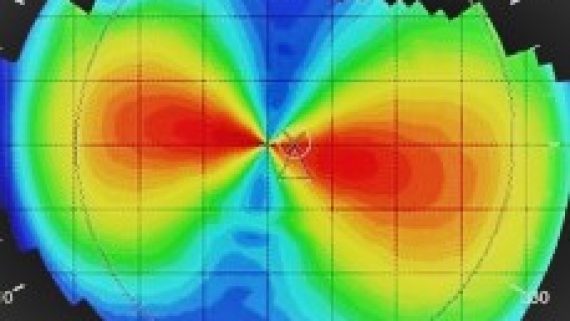 Astigmatismo topografico